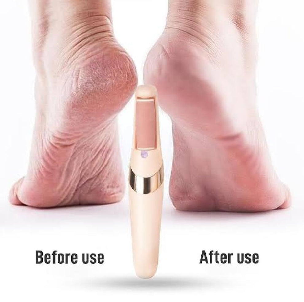 Electric Foot Callus Remover – Rechargeable Pedicure File for Dead Skin, Cracked Heels & Smooth Feet